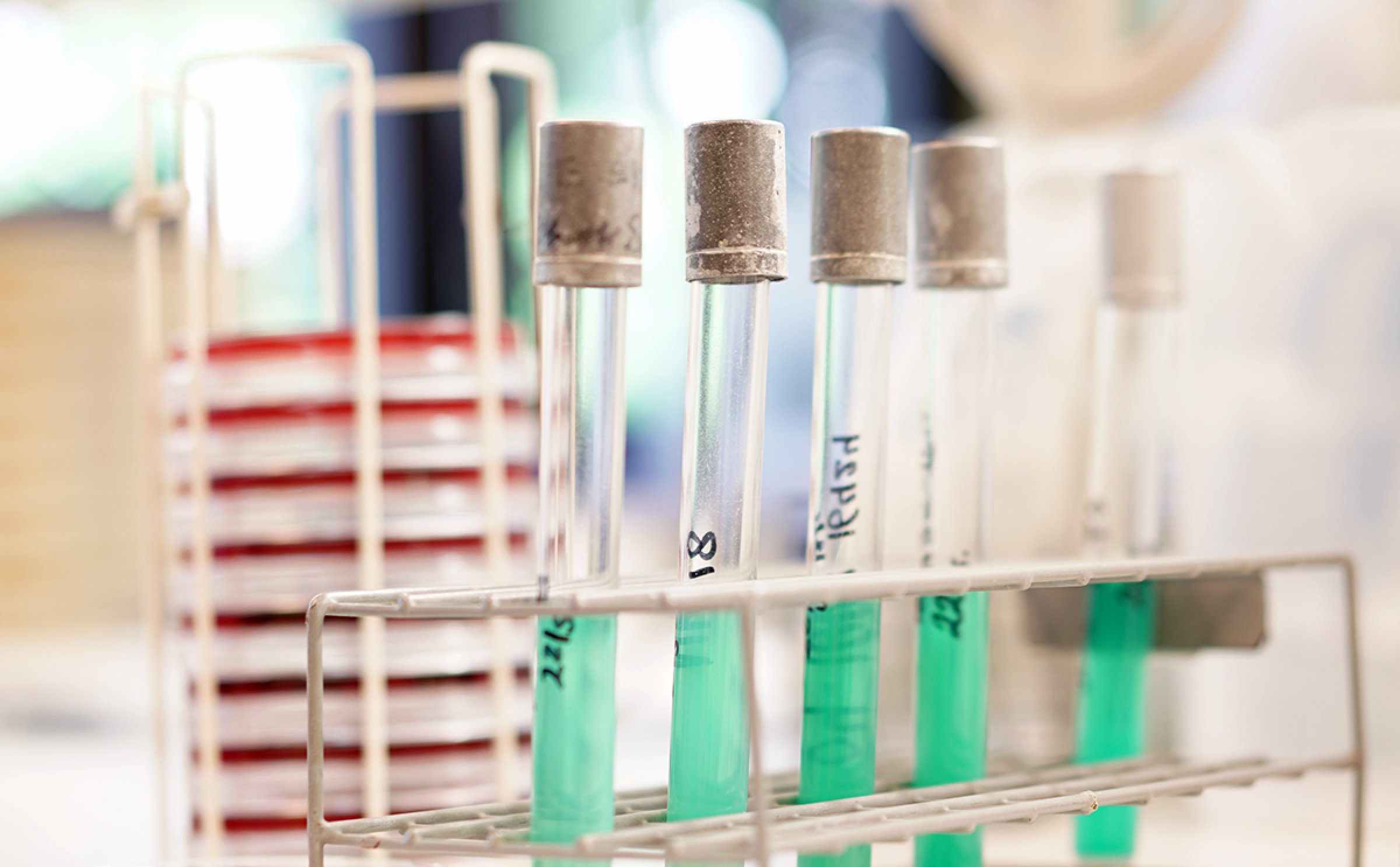 The Norwegian Veterinary Institute (NVI) co-ordinated the NORM-VET monitoring programme on behalf of Mattilsynet (Norwegian Food Safety Authority), as well as the monitoring of antibiotics for animals. Photo: Eivind Røhne